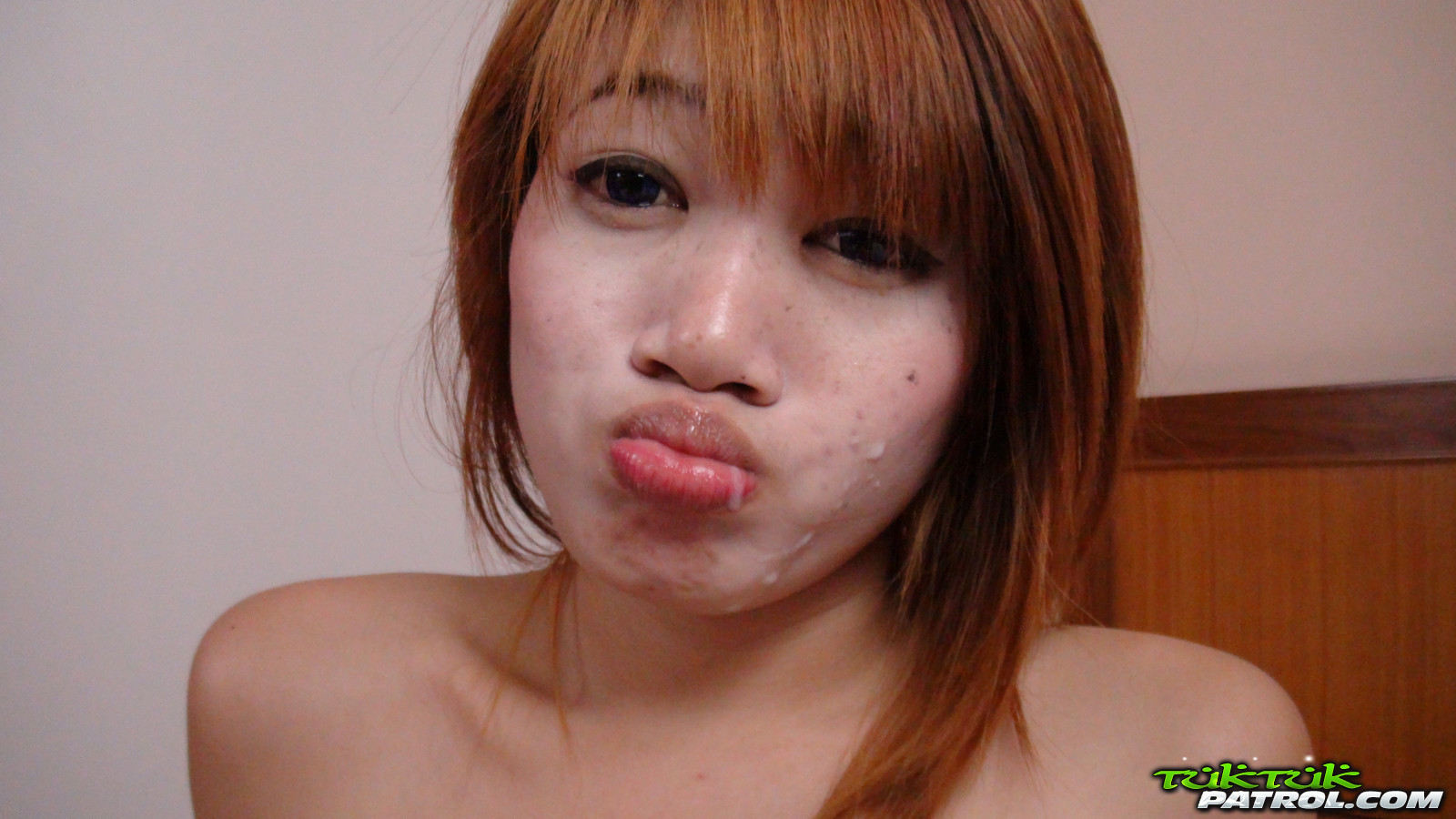 best of Asian freckle